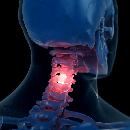 3d rendered medically accurate illustration of a painful neck