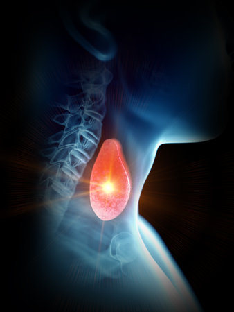 3d rendered medically accurate illustration of a painful thyroid glandの写真素材