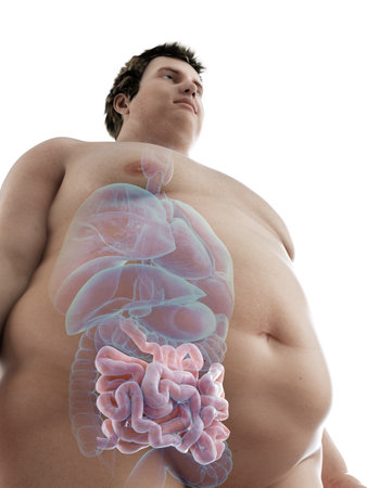 3d rendered medically accurate illustration of an obese mans intestineの写真素材