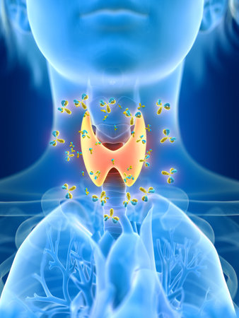3d rendered medically accurate illustration of a females thyroid gland being attacked by antibodies
