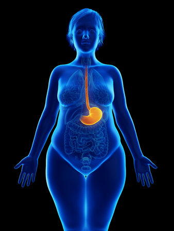 3d rendered medically accurate illustration of an obese womans stomachの写真素材