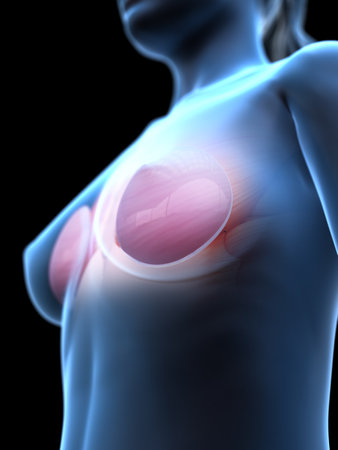 3d rendered medically accurate illustration of a womans breast implantsの写真素材