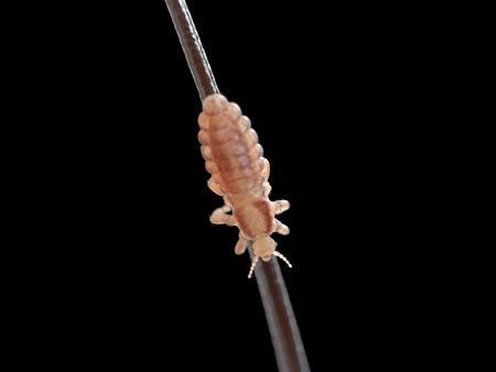3d rendered illustration of a head louse