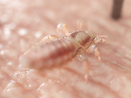 3d rendered illustration of a head louse