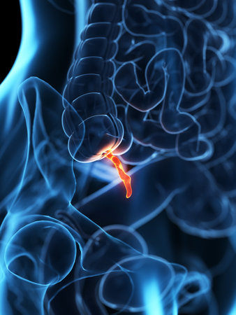 3d rendered medically accurate illustration of an inflamed appendix