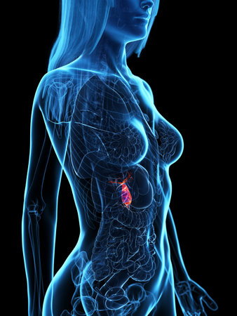 3d rendered medically accurate illustration of a diseased gallbladder