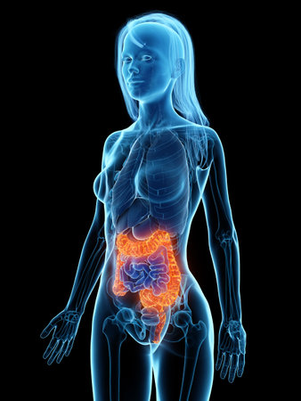 3d rendered medically accurate illustration of a diseased colon