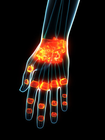 3d rendered medically accurate illustration of inflamed ligamentsの写真素材