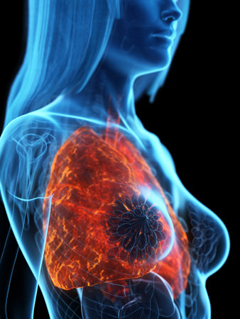 3d rendered medically accurate illustration of a diseased lungの写真素材