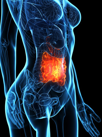 3d rendered medically accurate illustration of a diseases small intestineの写真素材