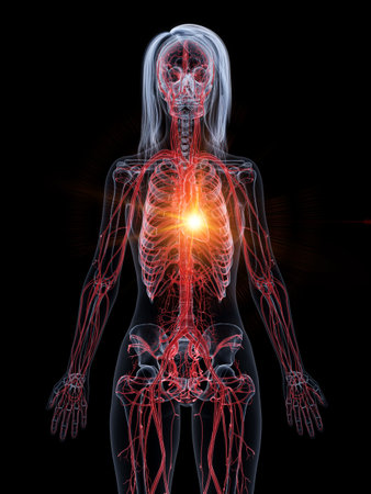 3d rendered medically accurate illustration of a heart attackの写真素材