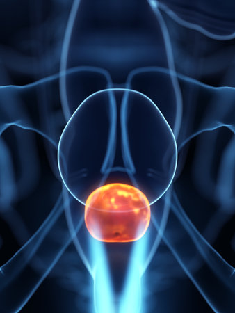 3d rendered medically accurate illustration of an inflamed prostate