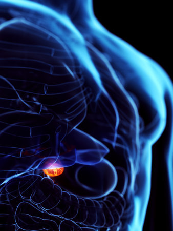 3d rendered medically accurate illustration of a diseased gallbladderの写真素材