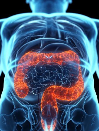 3d rendered medically accurate illustration of a diseased colon
