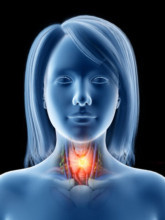 3d rendered medically accurate illustration of thyroid cancerの素材 [FY310119081279]