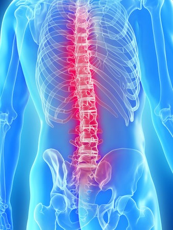 3d rendered medically accurate illustration of a mans painful back