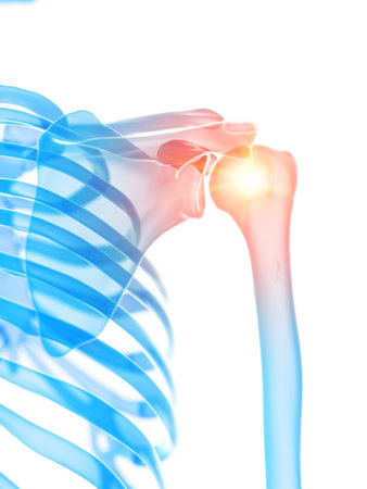 3d rendered medically accurate illustration of the shoulder joint showing painの写真素材