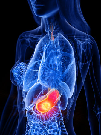 3d rendered medically accurate illustration of a womans stomach tumor