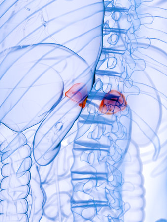 3d rendered medically accurate illustration of diseased adrenal glands