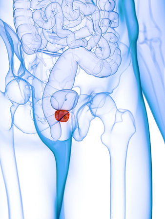 3d rendered medically accurate illustration of an inflamed prostate