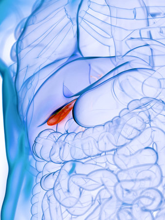 3d rendered medically accurate illustration of a diseased gallbladder