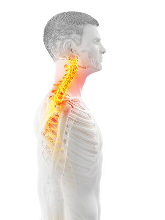 3d rendered medically accurate illustration of a mans painful neckの写真素材