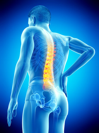 3d rendered medically accurate illustration of a mans painful back