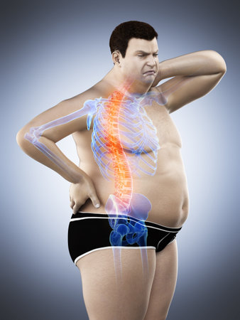 3d rendered medically accurate illustration of an obese mans painful back