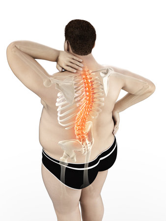 3d rendered medically accurate illustration of an obese mans painful back