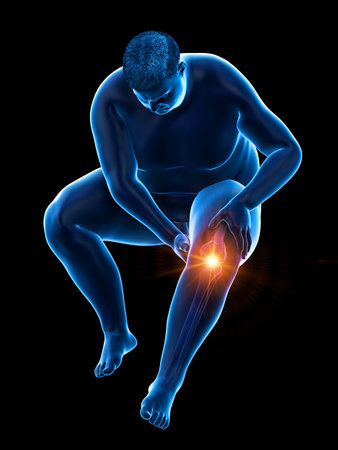 3d rendered medically accurate illustration of an obese mans painful kneeの写真素材