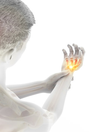 3d rendered medically accurate illustration of a man having a painful wristの写真素材