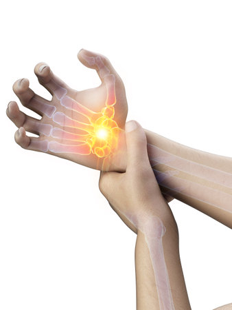 3d rendered medically accurate illustration of a man having a painful wristの写真素材