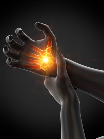 3d rendered medically accurate illustration of a man having a painful wristの写真素材