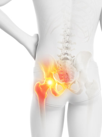 3d rendered medically accurate illustration of a man having a painful hip joint