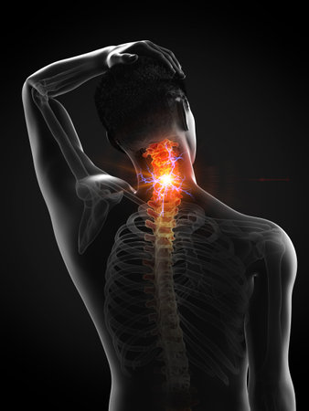 3d rendered medically accurate illustration of a man having acute back painの写真素材