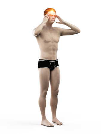 3d rendered medically accurate illustration of a man suffering from headacheの写真素材