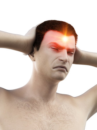 3d rendered medically accurate illustration of a man having a headacheの写真素材