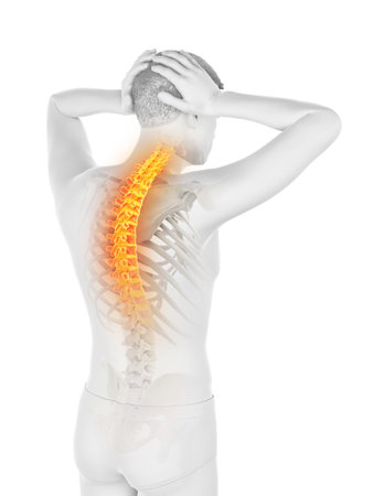 3d rendered medically accurate illustration of a man having a backache