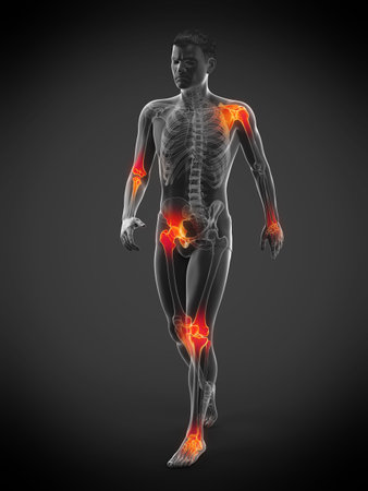 3d rendered medically accurate illustration of a walkers painful jointsの写真素材