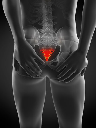 3d rendered medically accurate illustration of a painful tailboneの写真素材