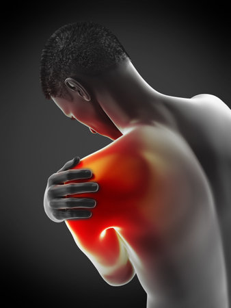 3d rendered medically accurate illustration of a painful elbowの写真素材