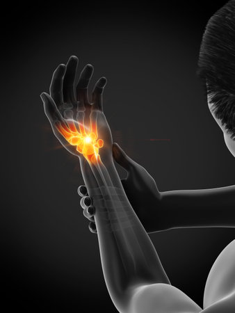 3d rendered medically accurate illustration of a man having a painful wristの写真素材
