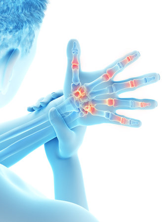 3d rendered medically accurate illustration of a mans painful fingersの写真素材