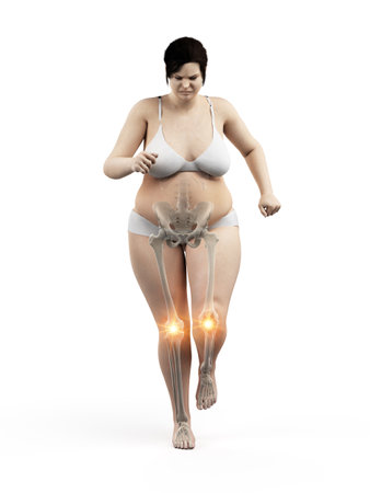3d rendered medically accurate illustration of an overweight womans painful kneesの写真素材