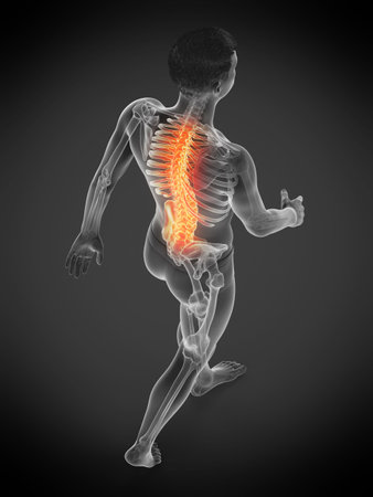 3d rendered medically accurate illustration of a man having a backache
