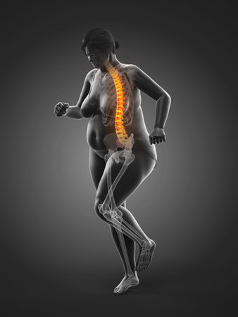 3d rendered medically accurate illustration of an obese womansの写真素材