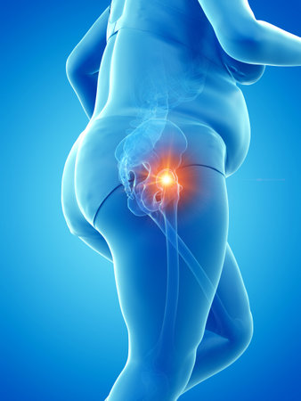 3d rendered medically accurate illustration of an obese womansの写真素材