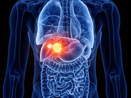 3d rendered medically accurate illustration of liver cancerの写真素材
