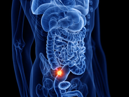 3d rendered medically accurate illustration of appendix cancerの写真素材