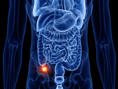 3d rendered medically accurate illustration of appendix cancerの写真素材